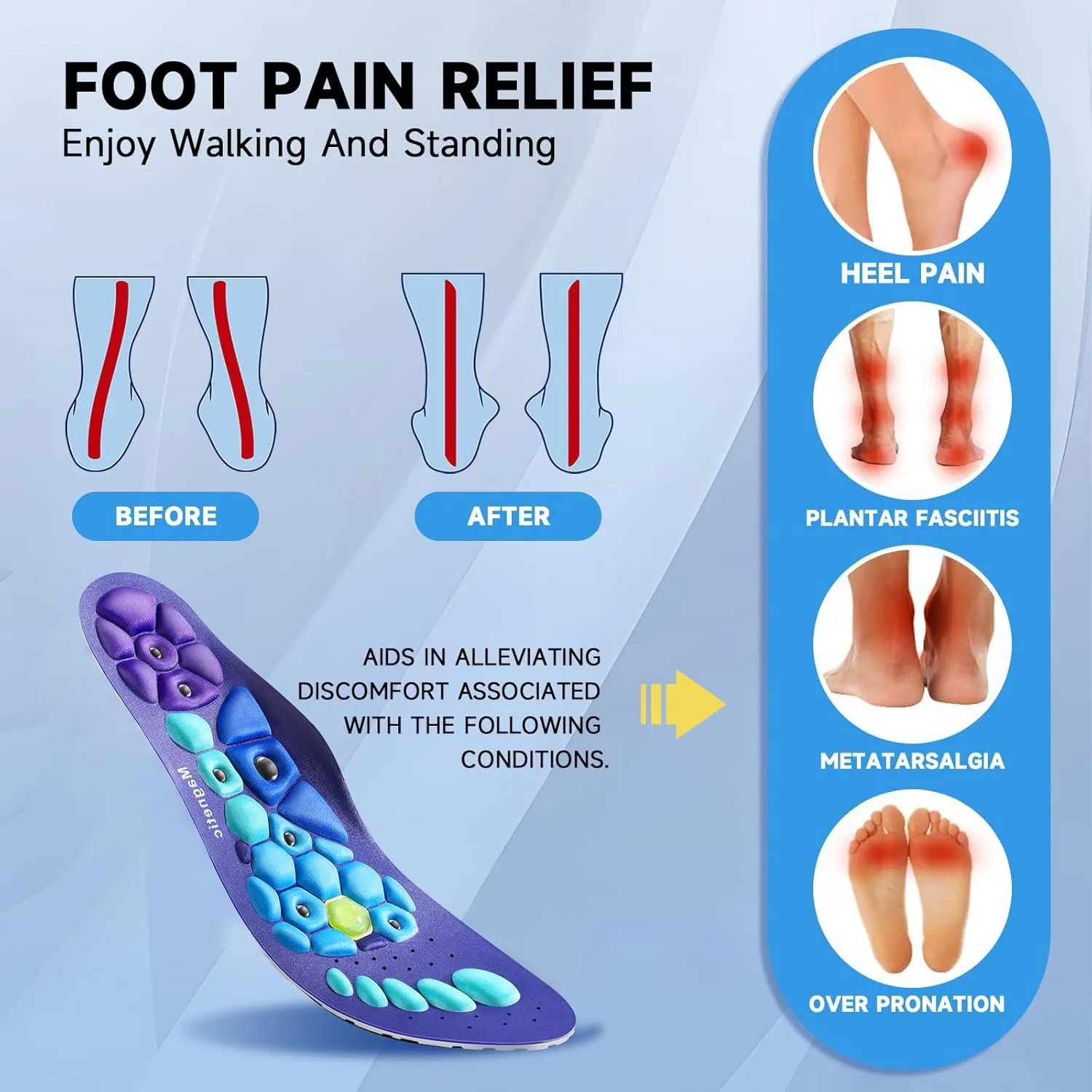 Acupressure Insoles for Men and Women - Orthopedic Acupoint Massage Insoles with Magnetic Technology, Shock Absorption, Non-Slip, Feet and Arch Support (Blue, L(Men 9.5-12/Women 10.5-13))